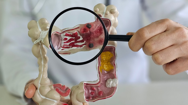 man holding model of colon