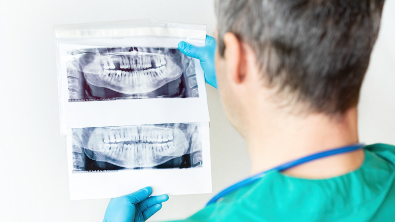 male dentist looking at x-ray