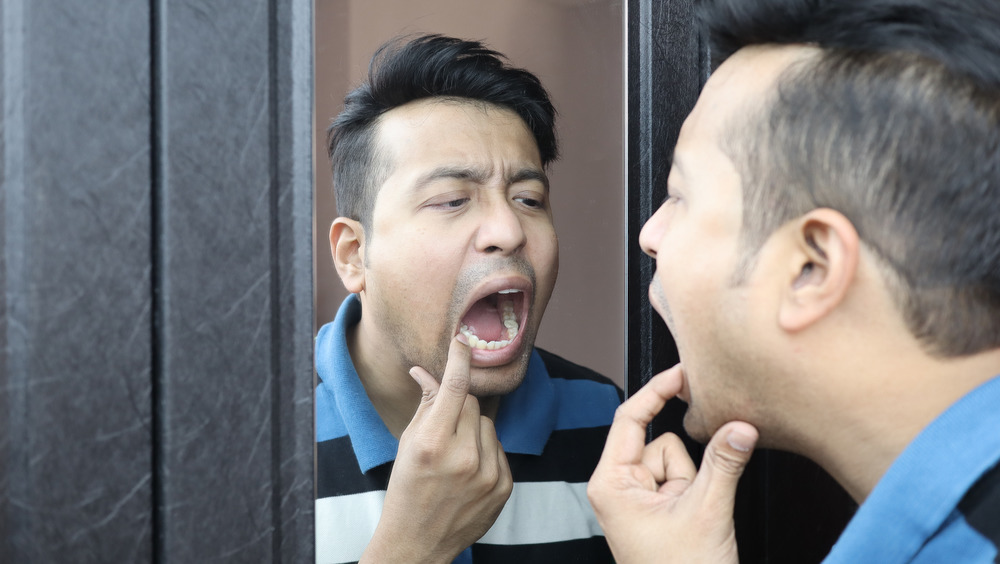 Man looking in mirror checking mouth for cavity
