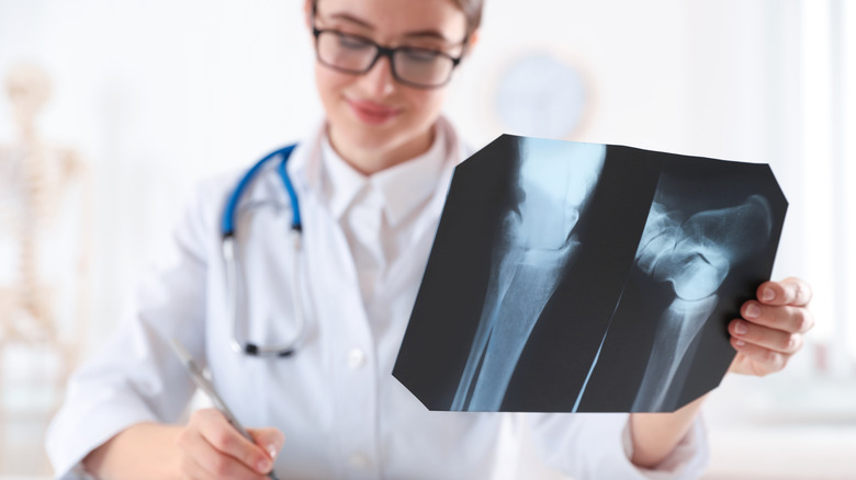 Female doctor analyzing knee x-rays