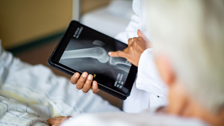 Doctor showing X-rays to patient