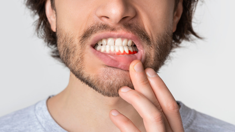 bearded man revealing red gums