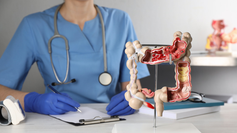 Doctor with model of human colon 