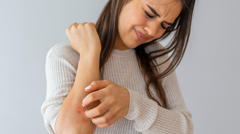 woman scratching an itch