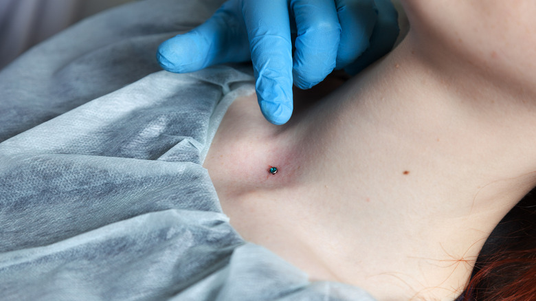 gloved hands examine an inflamed neck dermal piercing