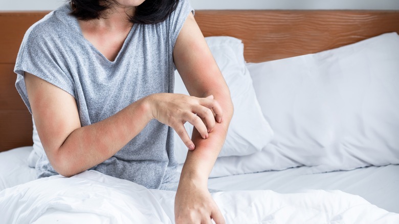 woman scratching an itchy rash on her arm