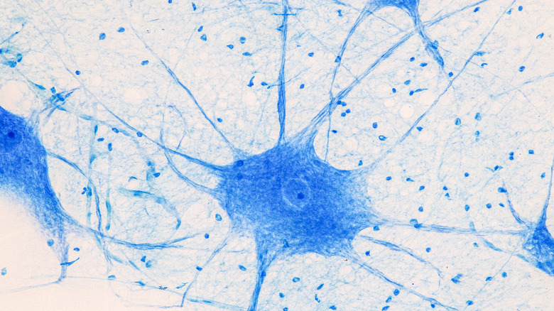 image of a brain cell