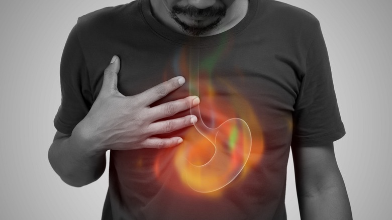 Man with heartburn and a holographic image of the stomach and esophagus 