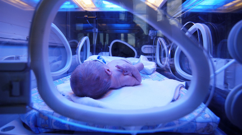 newborn baby with jaundice in incubator