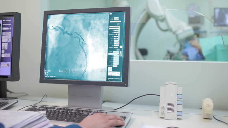 A doctor looks at hear vessels on a computer