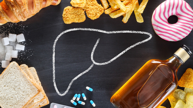 Liver drawing surrounded by unhealthy foods