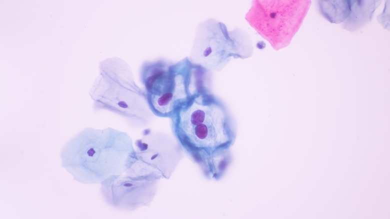 Cancerous cells close-up
