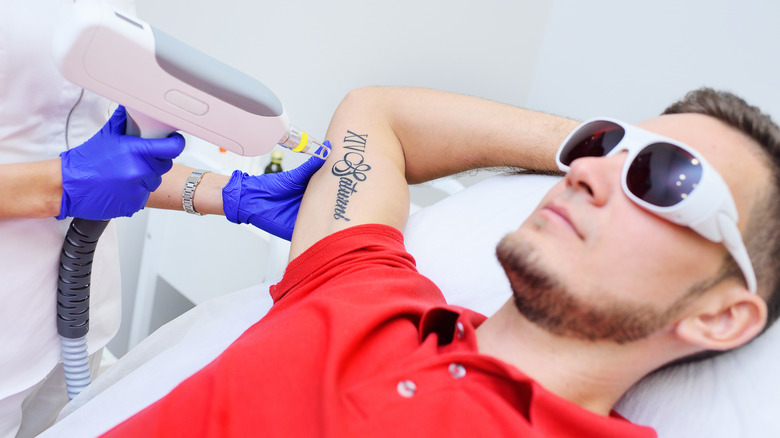 Man laying down getting tattoo removed on arm with laser