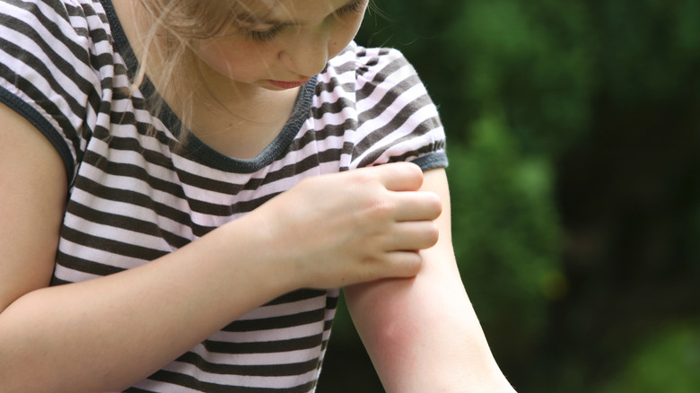 Girl checking bug bite on arm