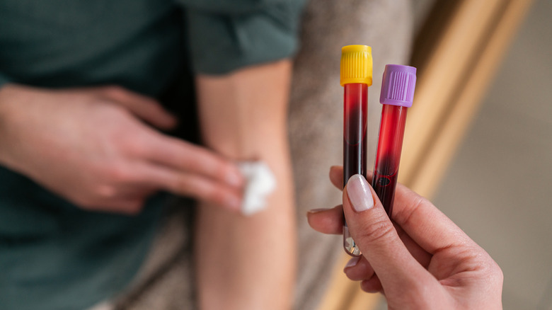 Blood vials after blood draw