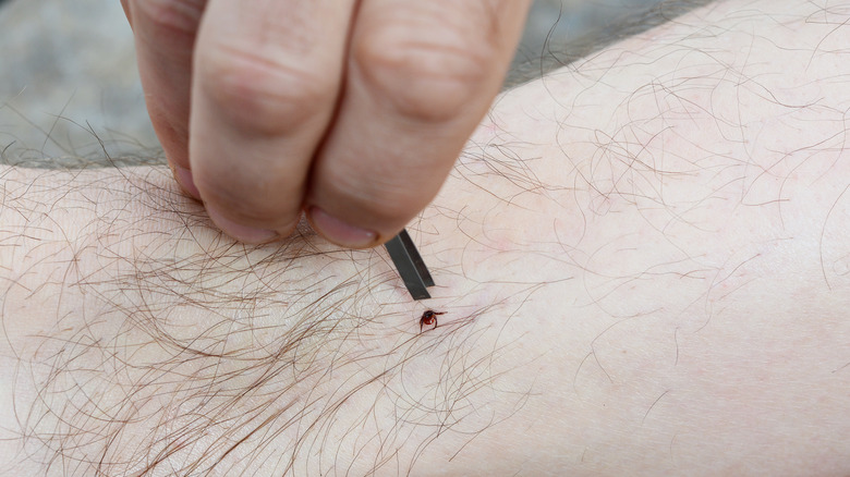 Tick removal with tweezer