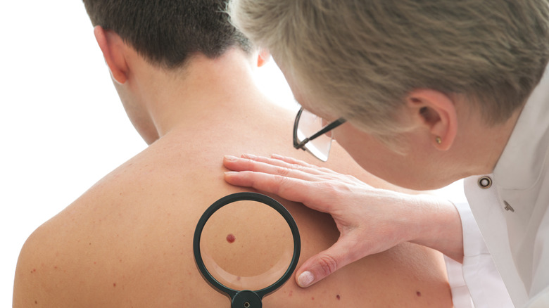 Dermatologist using magnifying glass on patient