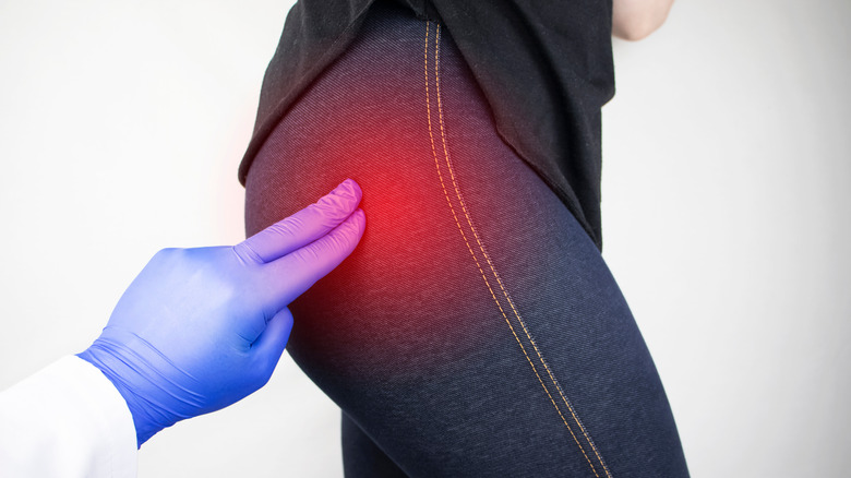 Woman with pain from piriformis syndrome