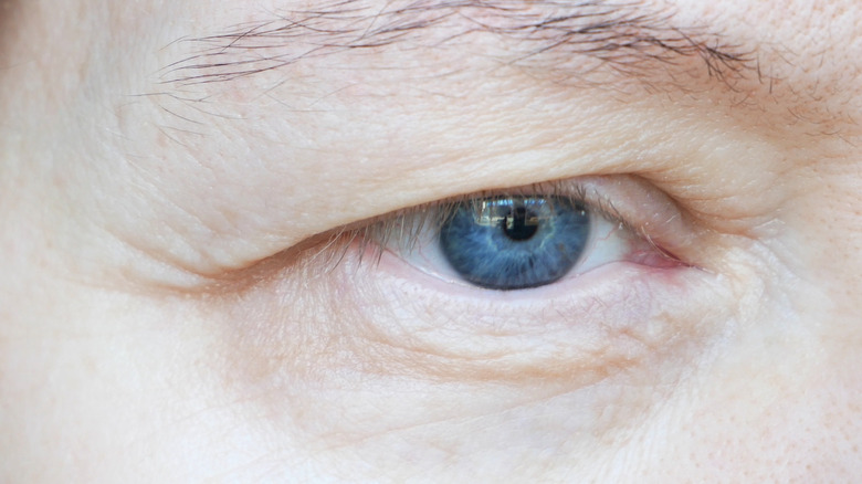 Discovernet Reasons You Should Avoid Rubbing Your Eyes