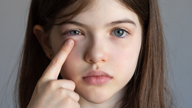 girl with conjunctivitis touches eye