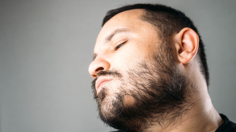 Man with alopecia areata barbae