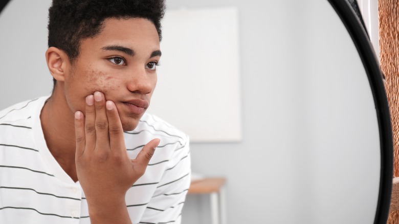 young man looking at acne