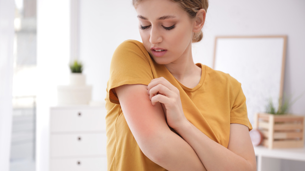 Woman in yellow shirt looking at her arm and scratching