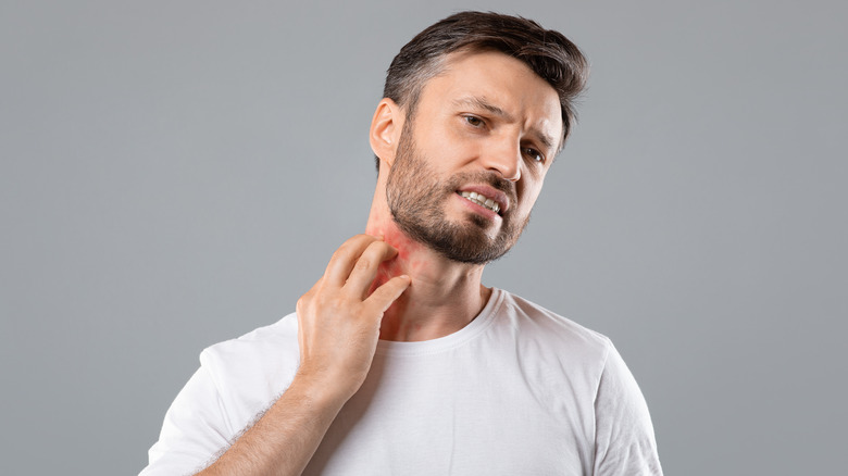 Man scratching a red rash on his neck