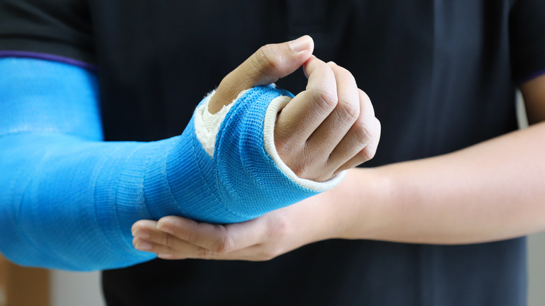 Close up of a person in a black t-shirt holding their one arm, which is in a blue cast