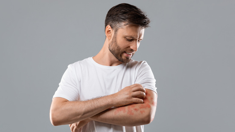 bearded man itching his skin 