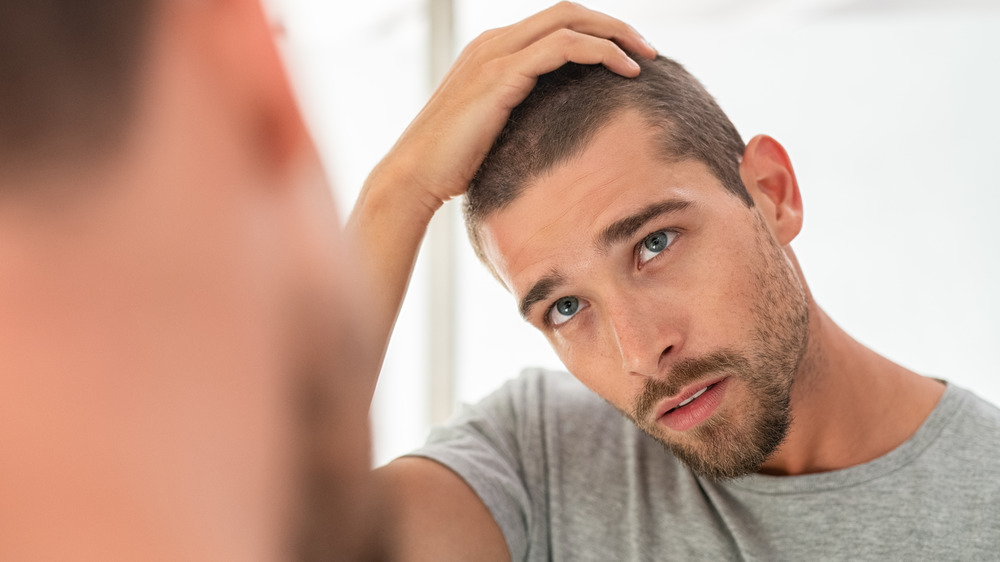 Hair loss from lack of vitamin D