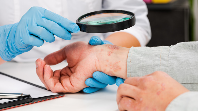 doctor examining patient's skin